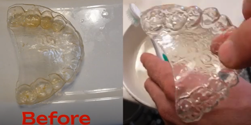 clean retainers with baking soda