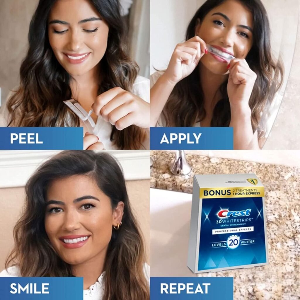 Best At-Home Teeth Whitening Kits